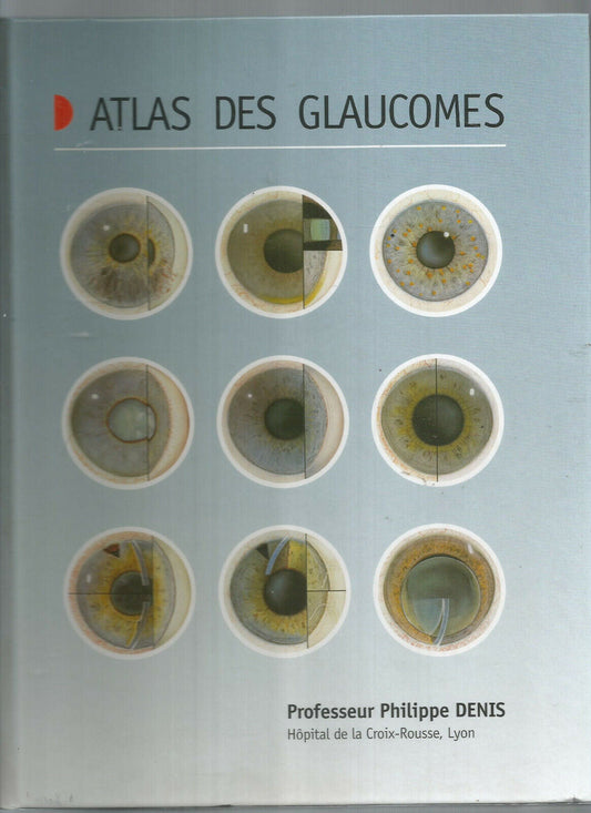 ATLAS DES GLAUCOMES