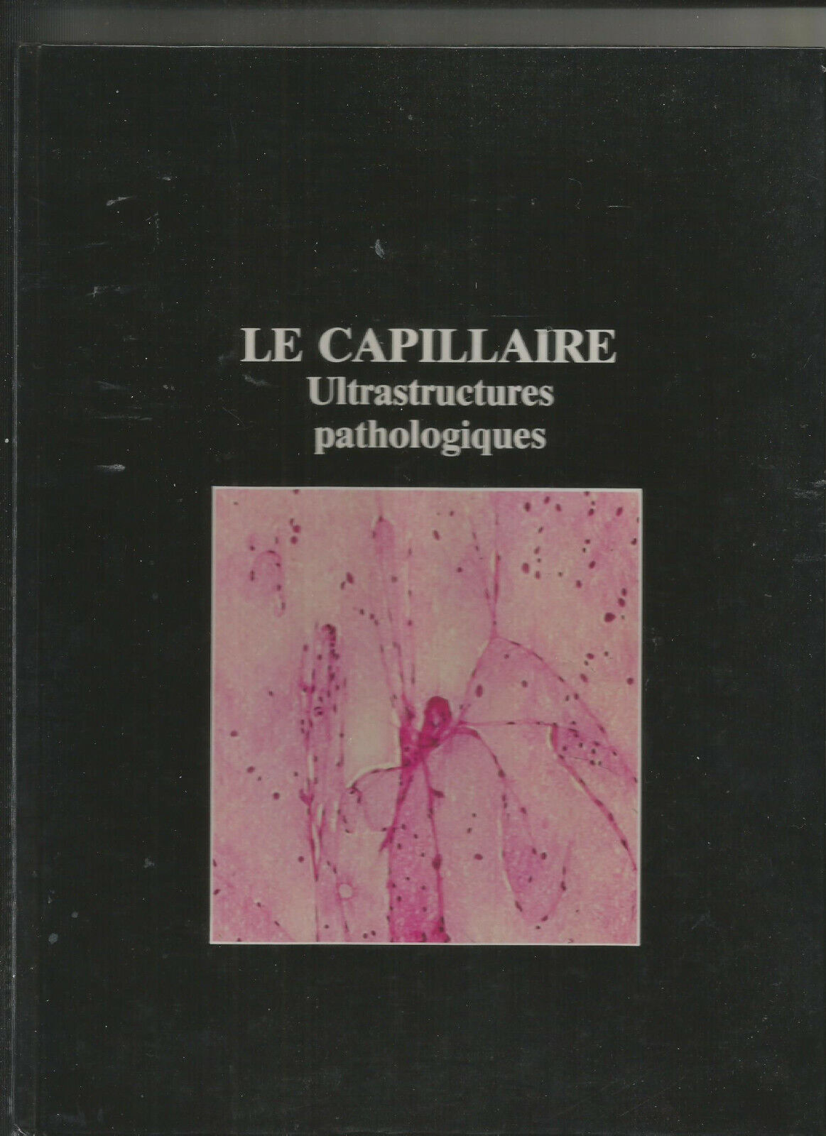 LE CAPILLAIRE